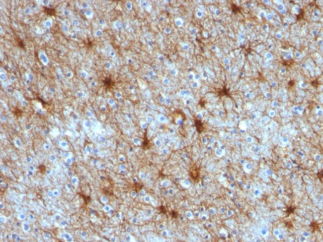 GFAP (Astrocyte and Neural Stem Cell Marker) Antibody in Immunohistochemistry (Paraffin) (IHC (P))