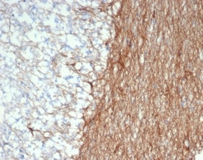 GFAP (Astrocyte and Neural Stem Cell Marker) Antibody in Immunohistochemistry (Paraffin) (IHC (P))