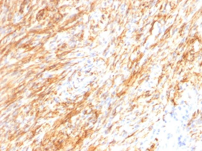 GFAP (Astrocyte and Neural Stem Cell Marker) Antibody in Immunohistochemistry (Paraffin) (IHC (P))