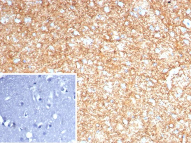 GFAP (Astrocyte and Neural Stem Cell Marker) Antibody in Immunohistochemistry (Paraffin) (IHC (P))