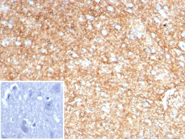 GFAP (Astrocyte and Neural Stem Cell Marker) Antibody in Immunohistochemistry (Paraffin) (IHC (P))