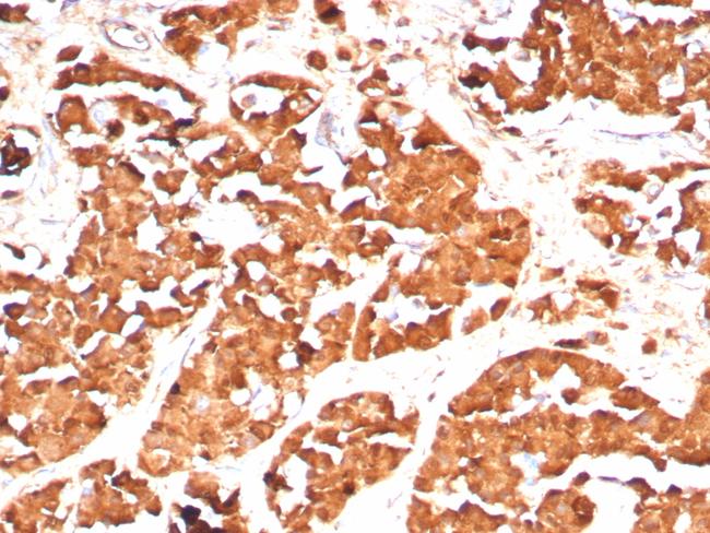 Growth Hormone (Pituitary Marker) Antibody in Immunohistochemistry (Paraffin) (IHC (P))