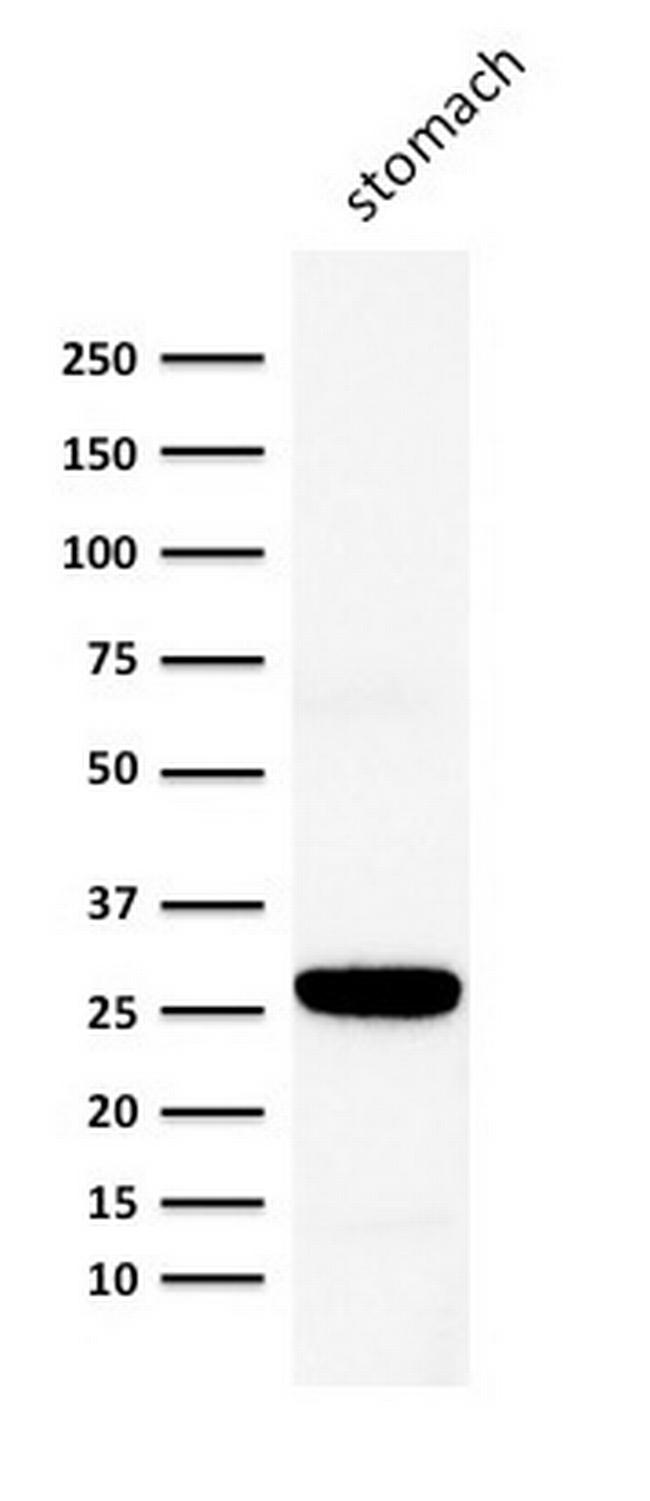 Connexin 32 (Gap Junction Protein) Antibody in Western Blot (WB)