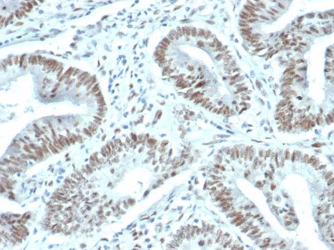 FOXP1 (Transcription Factor) Antibody in Immunohistochemistry (Paraffin) (IHC (P))