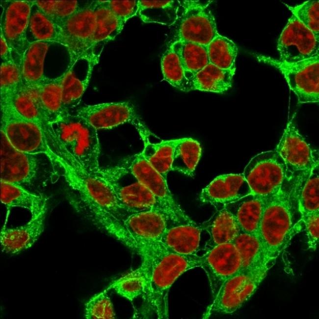 Glypican-3 (GPC3) (Hepatocellular Carcinoma Marker) Antibody in Immunocytochemistry (ICC/IF)