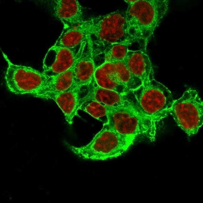 Glypican-3 (GPC3) (Hepatocellular Carcinoma Marker) Antibody in Immunocytochemistry (ICC/IF)