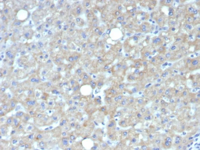 Glypican-3 (GPC3) (Hepatocellular Carcinoma Marker) Antibody in Immunohistochemistry (Paraffin) (IHC (P))