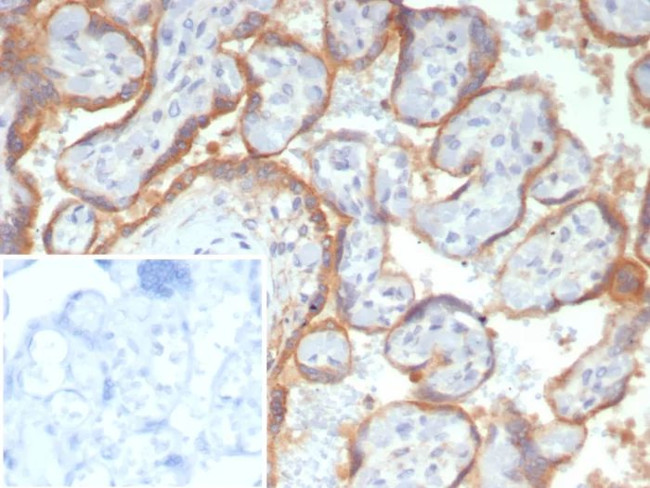 Glypican-3 (GPC3) (Hepatocellular Carcinoma Marker) Antibody in Immunohistochemistry (Paraffin) (IHC (P))