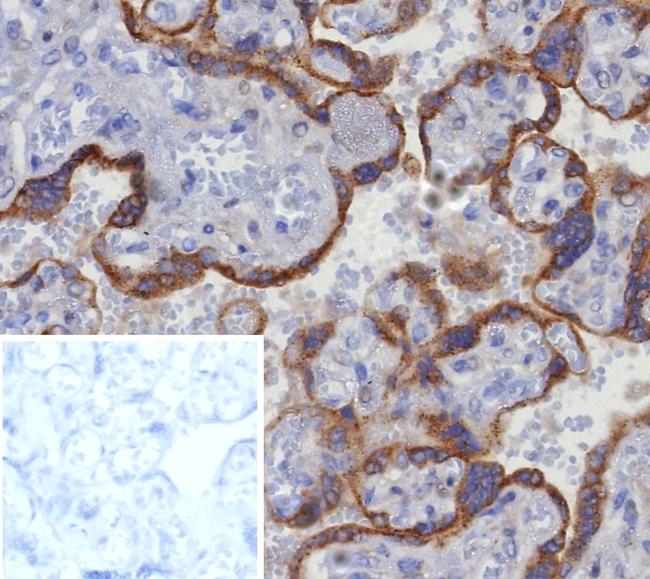 Glypican-3 (GPC3) (Hepatocellular Carcinoma Marker) Antibody in Immunohistochemistry (Paraffin) (IHC (P))