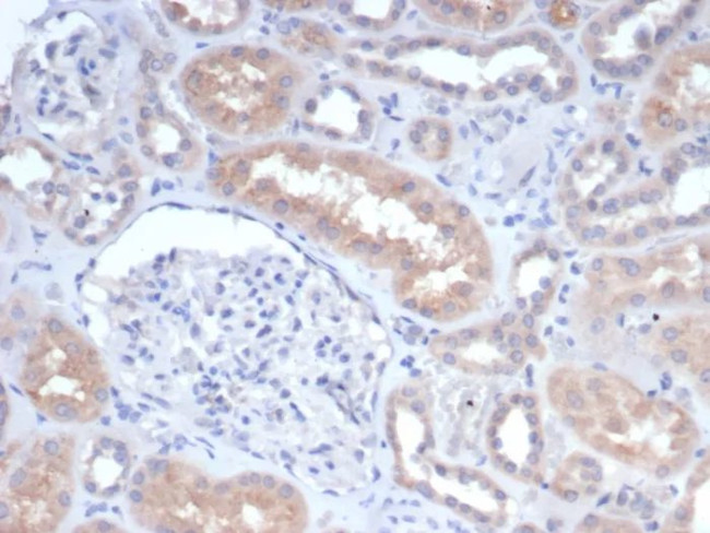 GCLM (DNA Mismatch Repair Protein) Antibody in Immunohistochemistry (Paraffin) (IHC (P))