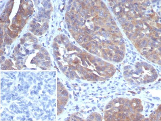 GCLM (DNA Mismatch Repair Protein) Antibody in Immunohistochemistry (Paraffin) (IHC (P))