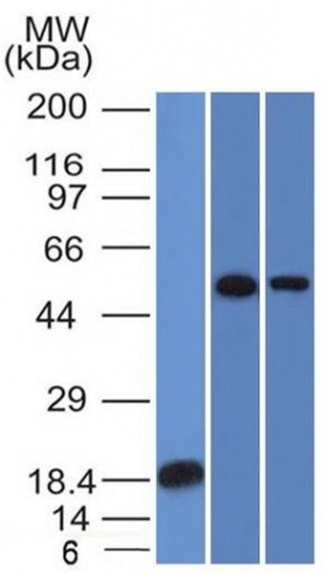 TOX3/TNRC9 Antibody in Western Blot (WB)