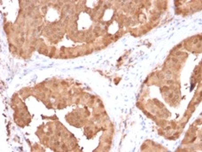 Glyoxalase 1 (GLO1) Antibody in Immunohistochemistry (Paraffin) (IHC (P))