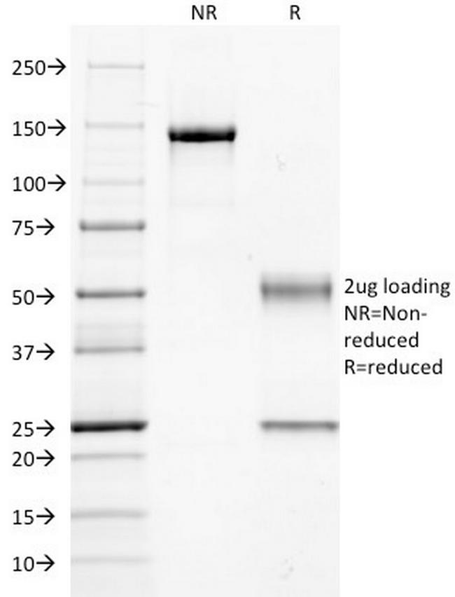 Guanine nucleotide-binding protein alpha-q/GNAQ/G-ALPHA-q Antibody in SDS-PAGE (SDS-PAGE)