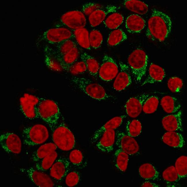 GnRH-Receptor/LH-RH Receptor Antibody in Immunocytochemistry (ICC/IF)