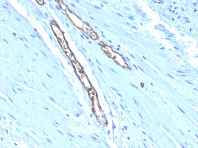 Blood Group Antigen A (CD173) Antibody in Immunohistochemistry (Paraffin) (IHC (P))