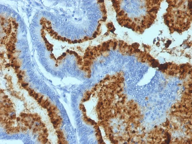 Blood Group Antigen B (CD173) Antibody in Immunohistochemistry (Paraffin) (IHC (P))