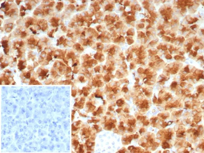 GP2 (Glycoprotein 2)/ZAP75 Antibody in Immunohistochemistry (Paraffin) (IHC (P))