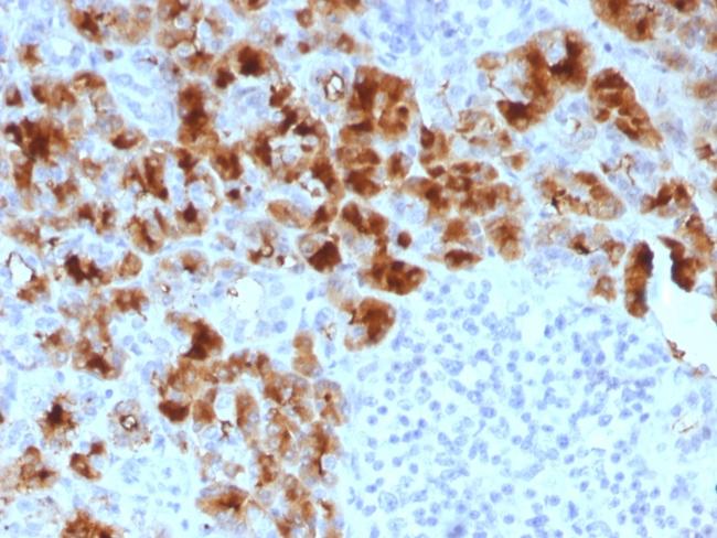 GP2 (Glycoprotein 2)/ZAP75 Antibody in Immunohistochemistry (Paraffin) (IHC (P))