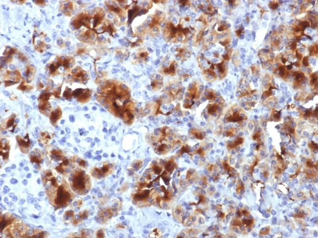 GP2 (Glycoprotein 2)/ZAP75 Antibody in Immunohistochemistry (Paraffin) (IHC (P))