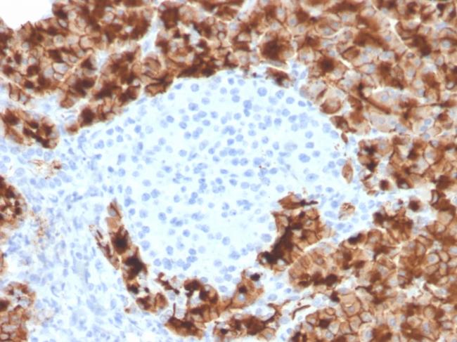 GP2 (Glycoprotein 2)/ZAP75 Antibody in Immunohistochemistry (Paraffin) (IHC (P))