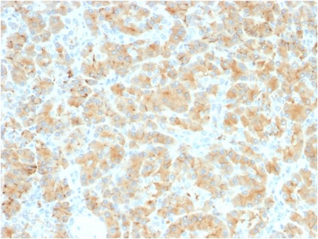 GP2 (Glycoprotein 2)/ZAP75 Antibody in Immunohistochemistry (Paraffin) (IHC (P))