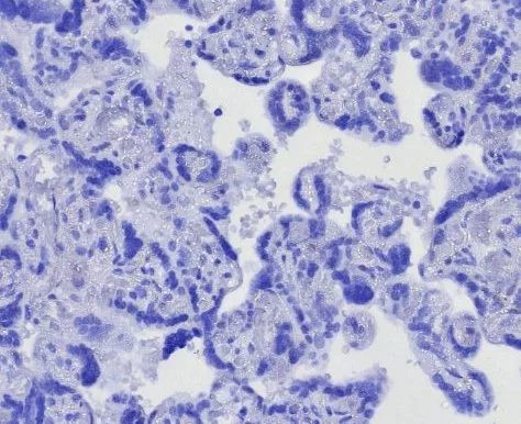 CD163L1 Antibody in Immunohistochemistry (Paraffin) (IHC (P))