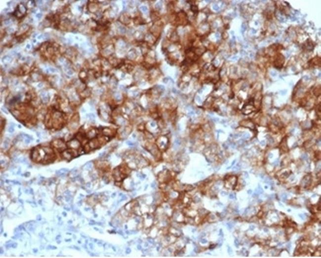 CD13/Aminopeptidase-N (Myeloid Cell Marker) Antibody in Immunohistochemistry (Paraffin) (IHC (P))