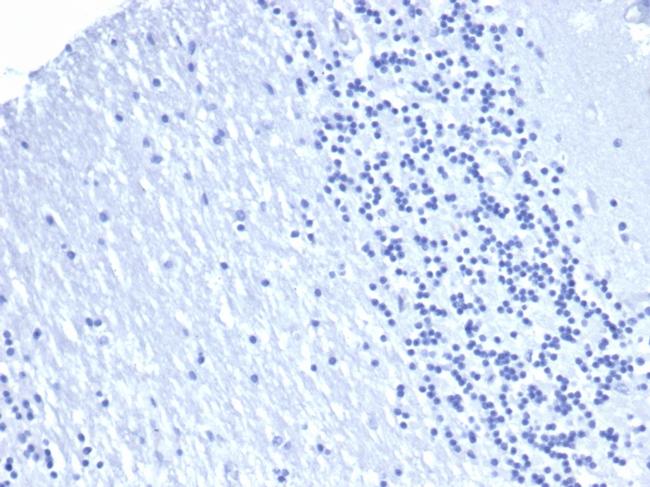 PD-L1/PDCD1LG1/CD274/B7-H1 (Cancer Immunotherapy Target) Antibody in Immunohistochemistry (Paraffin) (IHC (P))