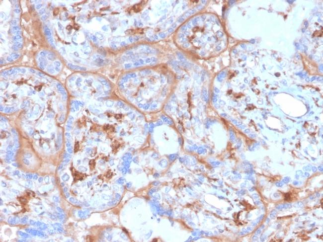 PD-L1/PDCD1LG1/CD274/B7-H1 (Cancer Immunotherapy Target) Antibody in Immunohistochemistry (Paraffin) (IHC (P))