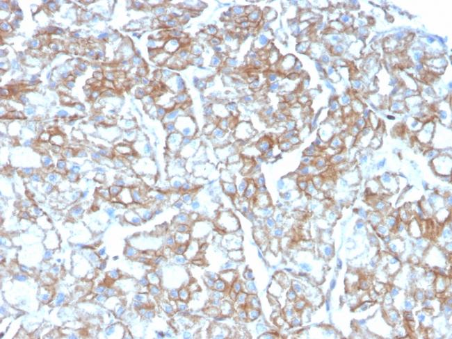 PD-L1/PDCD1LG1/CD274/B7-H1 (Cancer Immunotherapy Target) Antibody in Immunohistochemistry (Paraffin) (IHC (P))