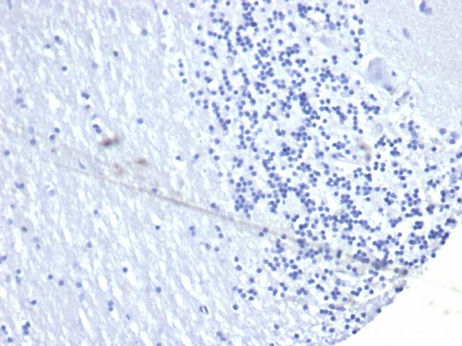 PD-L1/PDCD1LG1/CD274/B7-H1 (Cancer Immunotherapy Target) Antibody in Immunohistochemistry (Paraffin) (IHC (P))