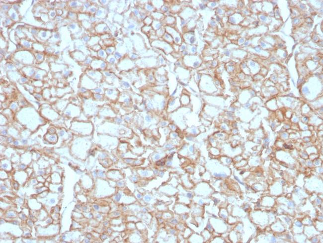 PD-L1/PDCD1LG1/CD274/B7-H1 (Cancer Immunotherapy Target) Antibody in Immunohistochemistry (Paraffin) (IHC (P))