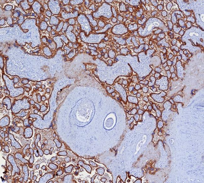 PD-L1/PDCD1LG1/CD274/B7-H1 (Cancer Immunotherapy Target) Antibody in Immunohistochemistry (Paraffin) (IHC (P))