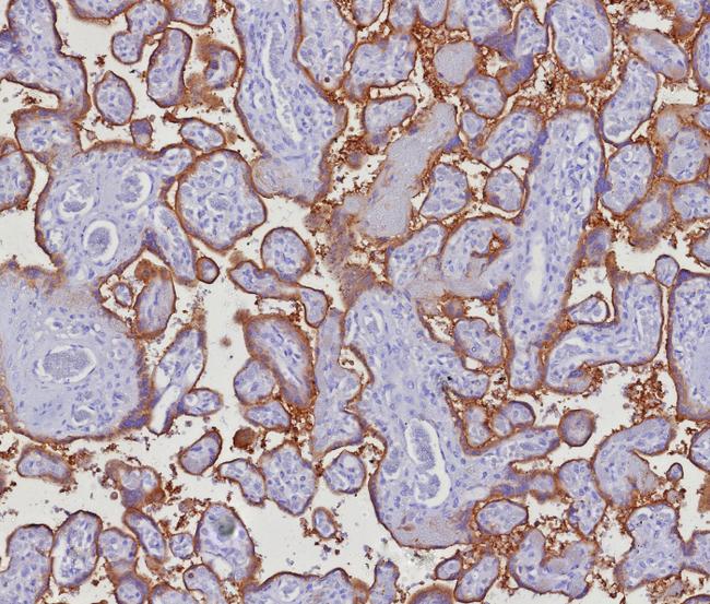 PD-L1/PDCD1LG1/CD274/B7-H1 (Cancer Immunotherapy Target) Antibody in Immunohistochemistry (Paraffin) (IHC (P))