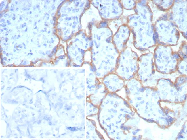 PD-L1/PDCD1LG1/CD274/B7-H1 (Cancer Immunotherapy Target) Antibody in Immunohistochemistry (Paraffin) (IHC (P))