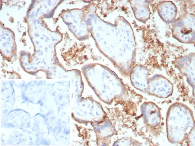 PD-L1/PDCD1LG1/CD274/B7-H1 (Cancer Immunotherapy Target) Antibody in Immunohistochemistry (Paraffin) (IHC (P))