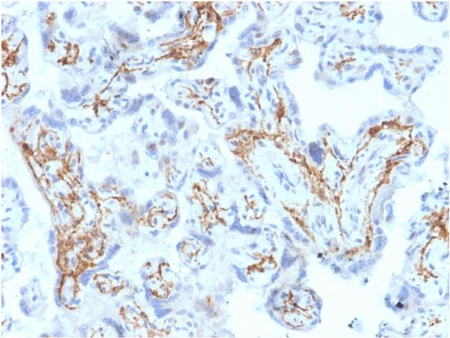 Glutathione S-Transferase Mu1 (GSTM1) Antibody in Immunohistochemistry (Paraffin) (IHC (P))