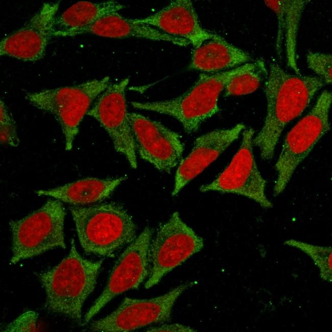 Glutathione S-Transferase Mu2 (GSTM2) Antibody in Immunocytochemistry (ICC/IF)