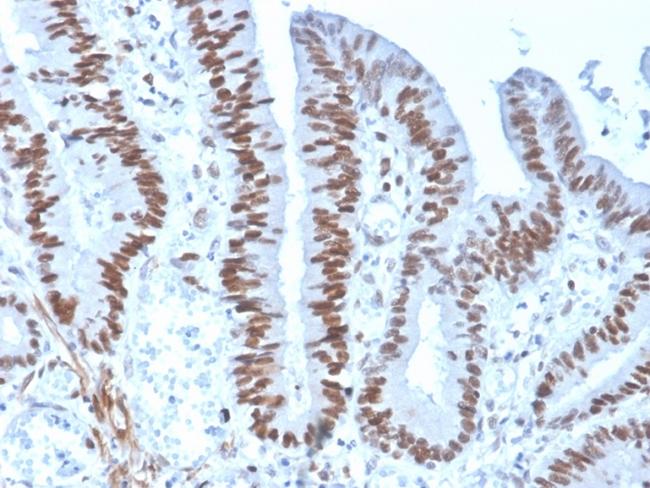 MSH6 (DNA Mismatch Repair Protein) Antibody in Immunohistochemistry (Paraffin) (IHC (P))