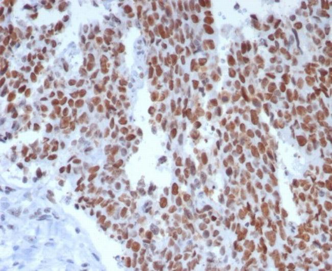 MSH6 (DNA Mismatch Repair Protein) Antibody in Immunohistochemistry (Paraffin) (IHC (P))