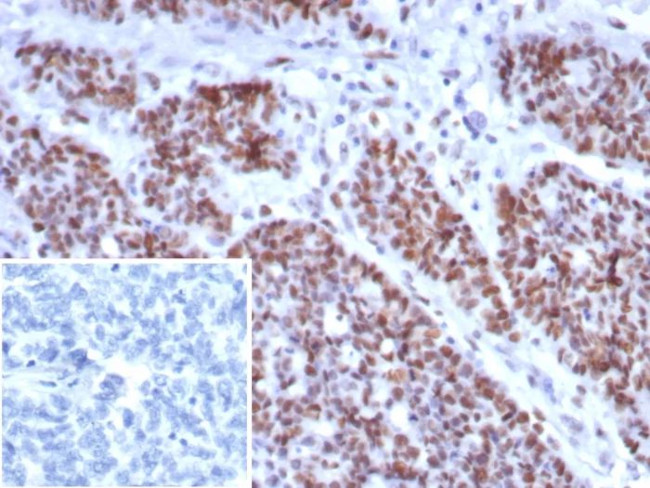 MSH6 (DNA Mismatch Repair Protein) Antibody in Immunohistochemistry (Paraffin) (IHC (P))