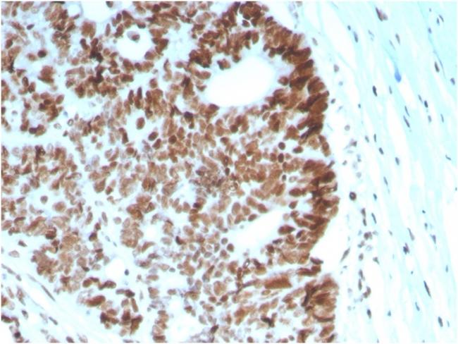 MSH6 (DNA Mismatch Repair Protein) Antibody in Immunohistochemistry (Paraffin) (IHC (P))