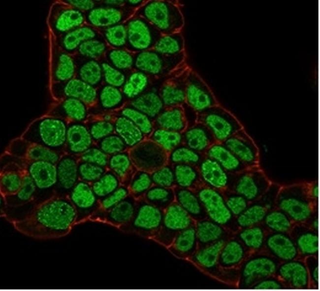 MSH6 (DNA Mismatch Repair Protein) Antibody in Immunocytochemistry (ICC/IF)