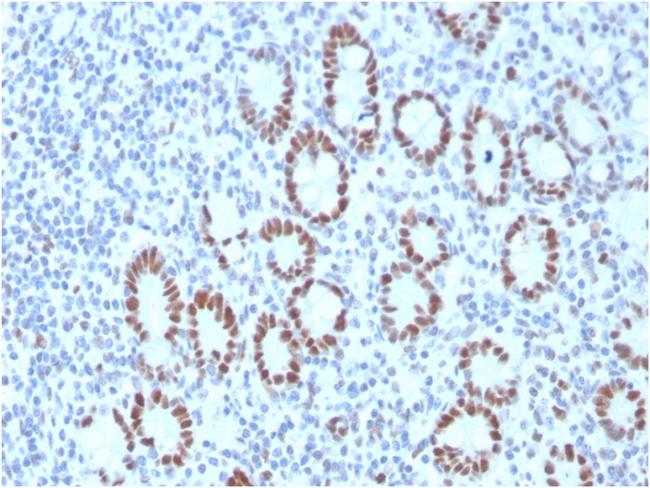 MSH6 (DNA Mismatch Repair Protein) Antibody in Immunohistochemistry (Paraffin) (IHC (P))