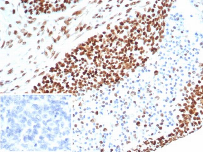 MSH6 (DNA Mismatch Repair Protein) Antibody in Immunohistochemistry (Paraffin) (IHC (P))