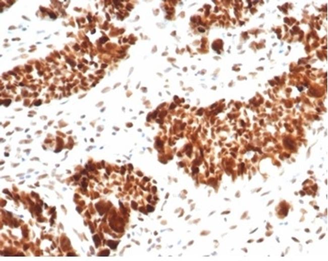 MSH6 (DNA Mismatch Repair Protein) Antibody in Immunohistochemistry (Paraffin) (IHC (P))