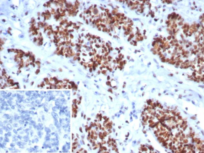 MSH6 (DNA Mismatch Repair Protein) Antibody in Immunohistochemistry (Paraffin) (IHC (P))