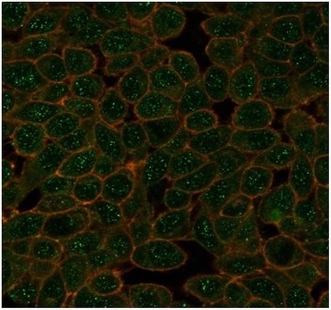 GTF2A1/ TFIIA (Transcription Factor) Antibody in Immunocytochemistry (ICC/IF)