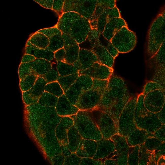 GTF2H2/BTF2/TFIIH Basal Transcription Factor Antibody in Immunocytochemistry (ICC/IF)